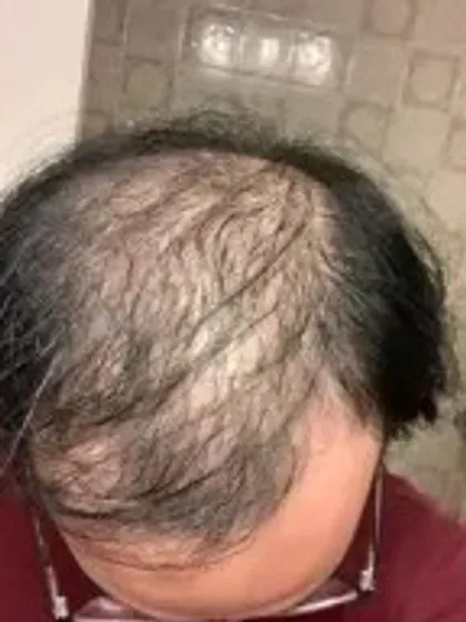 قبل الاستخدام